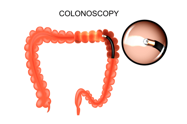 Gastroenterology diagram chart colonoscopy