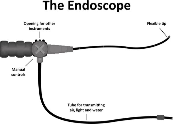 Endoscope diagram chart for sigmoidoscopy blog